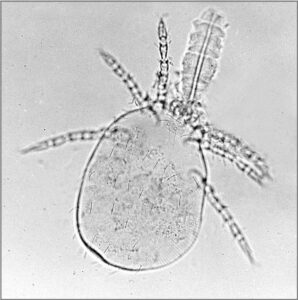 Microscopic close-up of a chigger mite larva (Trombiculidae)