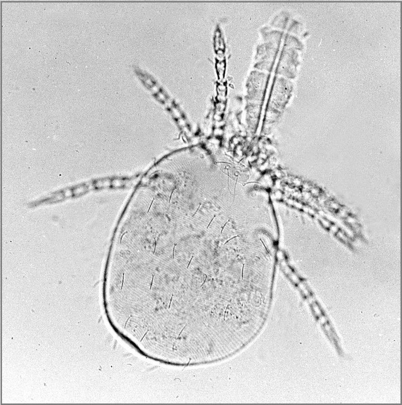 Microscopic close-up of a chigger mite larva (Trombiculidae)